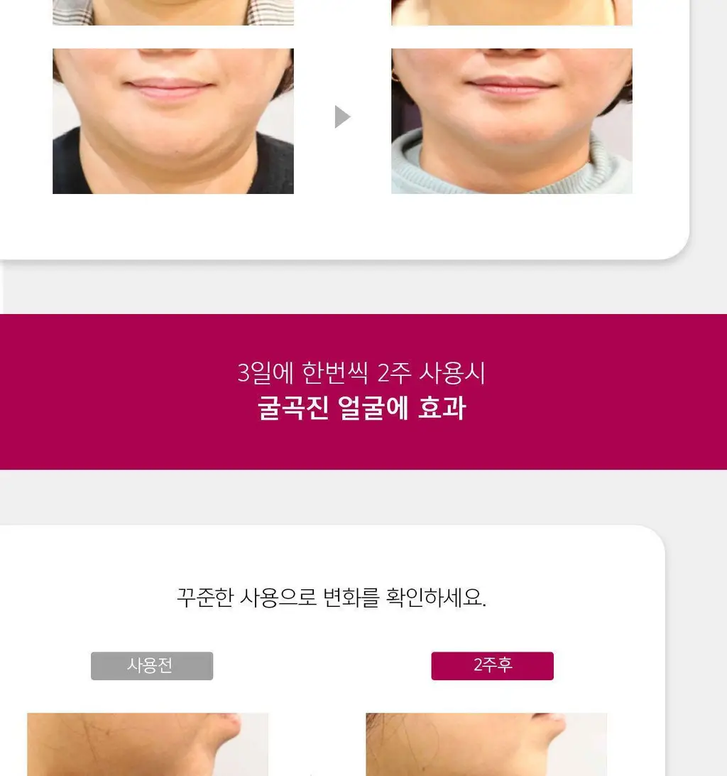 [브이라인/리프팅 패치] 아나시스 벨라컨투어 듀얼리프트마스크 5매 상세페이지 9